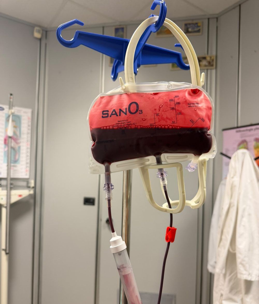 Sacca sterile monouso per grande autoemoterapia con ozono durante una seduta nello studio di Rapallo: il sangue prelevato è a contatto con la miscela ossigeno-ozono in sistema chiuso, con la scala graduata dei volumi visibile sulla sacca