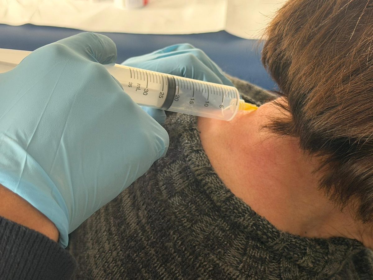 Infiltrazione sottocutanea cervicale